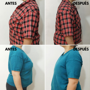 antes y despues